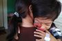 Polres Mentawai Bersama Pengurus Pramuka Serahkan Bantuan Kepada Wahyu Penderita Penyakit Tumor di Mata
